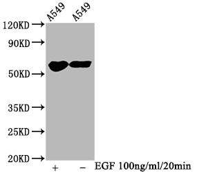 Western Blot<br />Positive WB detected in A549 whole cell lysate(treated with EGF or not)<br />All lanes Phospho-PAK1/PAK2/PAK3 antibody at 1.2μg/ml<br />Secondary<br />Goat polyclonal to rabbit IgG at 1/50000 dilution<br />Predicted band size: 65 KDa<br />Observed band size: 65 KDa<br />