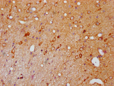 IHC image of CSB-RA017407A144phHU diluted at 1:100 and staining in paraffin-embedded rat brain tissue performed on a Leica BondTM system. After dewaxing and hydration, antigen retrieval was mediated by high pressure in a citrate buffer (pH 6.0). Section was blocked with 10% normal goat serum 30min at RT. Then primary antibody (1% BSA) was incubated at 4℃ overnight. The primary is detected by a biotinylated secondary antibody and visualized using an HRP conjugated SP system.