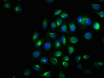 Immunofluorescence staining of Hela cells with CSB-RA007795A724phHU at 1:100, counter-stained with DAPI. The cells were fixed in 4% formaldehyde, permeabilized using 0.2% Triton X-100 and blocked in 10% normal Goat Serum. The cells were then incubated with the antibody overnight at 4°C. The secondary antibody was Alexa Fluor 488-congugated AffiniPure Goat Anti-Rabbit IgG(H+L).