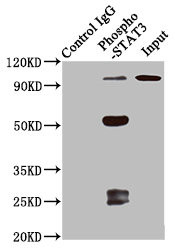 Immunoprecipitating Phospho-STAT3 in 293 whole cell lysate treated with Calyculin A<br />Lane 1: Rabbit control IgG(1μg)instead of CSB-RA022812A727phHU in 293 whole cell lysate treated with Calyculin A.For western blotting,a HRP-conjugated Protein G antibody was used as the secondary antibody (1/2000)<br />Lane 2: CSB-RA022812A727phHU(3μg)+ 293 whole cell lysate treated with Calyculin A(1mg)<br />Lane 3: 293 whole cell lysate treated with Calyculin A (20μg)<br />