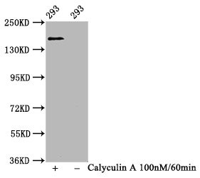 Western Blot<br />
Positive WB detected in 293 whole cell lysate(treated with Calyculin A or not)<br />
All lanes Phospho-SMC1A antibody at 1.11μg/ml<br />
Secondary<br />
Goat polyclonal to rabbit IgG at 1/50000 dilution<br />
Predicted band size: 160 KDa<br />
Observed band size: 160 KDa<br />