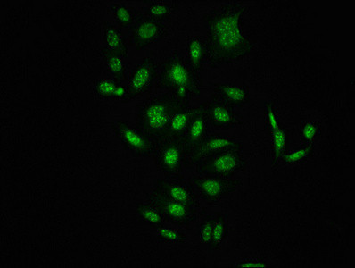 Immunofluorescence staining of HepG2 cells(treated with 50mM Calyculin A for 30min) with CSB-RA019284A621phHU at 1:100,counter-stained with DAPI. The cells were fixed in 4% formaldehyde, permeabilized using 0.2% Triton X-100 and blocked in 10% normal Goat Serum. The cells were then incubated with the antibody overnight at 4℃. The secondary antibody was Alexa Fluor 488-congugated AffiniPure Goat Anti-Rabbit IgG (H+L).