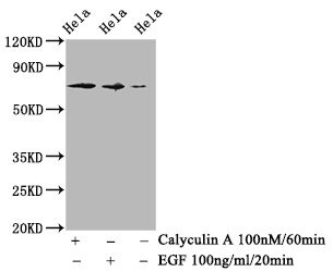 Western Blot<br />
Positive WB detected in Hela whole cell lysate(treated with Calyculin A or EGF)<br />
All lanes Phospho-RAF1 antibody at 1.18μg/ml<br />
Secondary<br />
Goat polyclonal to rabbit IgG at 1/50000 dilution<br />
Predicted band size: 73 KDa<br />
Observed band size: 73 KDa<br />