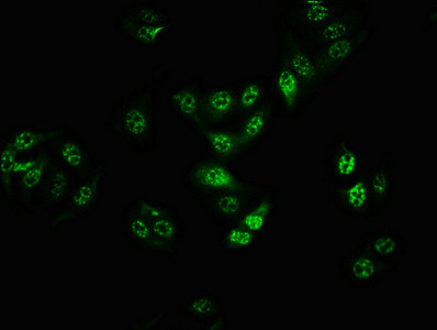 Immunofluorescence staining of HepG2 cells with CSB-RA002791A401phHU at 1:100,counter-stained with DAPI. The cells were fixed in 4% formaldehyde, permeabilized using 0.2% Triton X-100 and blocked in 10% normal Goat Serum. The cells were then incubated with the antibody overnight at 4℃. The secondary antibody was Alexa Fluor 488-congugated AffiniPure Goat Anti-Rabbit IgG (H+L).