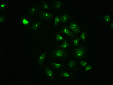 Immunofluorescence staining of A549 cells with CSB-RA011972A63phHU at 1:100,counter-stained with DAPI. The cells were fixed in 4% formaldehyde, permeabilized using 0.2% Triton X-100 and blocked in 10% normal Goat Serum. The cells were then incubated with the antibody overnight at 4&deg;C. The secondary antibody was Alexa Fluor 488-congugated AffiniPure Goat Anti-Rabbit IgG (H+L).