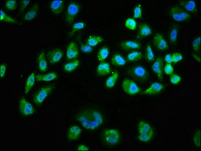 Immunofluorescence staining of Hela cells(treated with 100mM EGF for 20min) with CSB-RA001553A473phHU at 1:68,counter-stained with DAPI. The cells were fixed in 4% formaldehyde, permeabilized using 0.2% Triton X-100 and blocked in 10% normal Goat Serum. The cells were then incubated with the antibody overnight at 4℃. The secondary antibody was Alexa Fluor 488-congugated AffiniPure Goat Anti-Rabbit IgG (H+L).