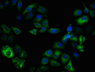 Immunofluorescence staining of Hela cells(treated with 50mM Calyculin A for 30min) with CSB-RA009963A09phHU at 1:100,counter-stained with DAPI. The cells were fixed in 4% formaldehyde, permeabilized using 0.2% Triton X-100 and blocked in 10% normal Goat Serum. The cells were then incubated with the antibody overnight at 4℃. The secondary antibody was Alexa Fluor 488-congugated AffiniPure Goat Anti-Rabbit IgG (H+L).
