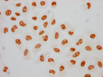 Immunocytochemistry analysis of CSB-RA018327A05phHU diluted at 1:75 and staining in Hela cells(treated with 100ng/ml EGF for 4h) performed on a Leica BondTM system. The cells were fixed in 4% formaldehyde, permeabilized using 0.2% Triton X-100 and blocked with 10% normal goat serum 30min at RT. Then primary antibody (1% BSA) was incubated at 4℃ overnight. The primary is detected by a biotinylated secondary antibody and visualized using an HRP conjugated SP system.