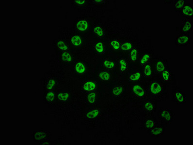 Immunofluorescence staining of Hela cells with CSB-RA018327A05phHU at 1:100,counter-stained with DAPI. The cells were fixed in 4% formaldehyde, permeabilized using 0.2% Triton X-100 and blocked in 10% normal Goat Serum. The cells were then incubated with the antibody overnight at 4℃. The secondary antibody was Alexa Fluor 488-congugated AffiniPure Goat Anti-Rabbit IgG (H+L).