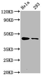 Western Blot<br />Positive WB detected in Hela whole cell lysate,293 whole cell lysate<br />All lanes Phospho-CREB1 antibody at 1.65μg/ml<br />Secondary<br />Goat polyclonal to rabbit IgG at 1/50000 dilution<br />Predicted band size: 46 KDa<br />Observed band size: 46 KDa<br />