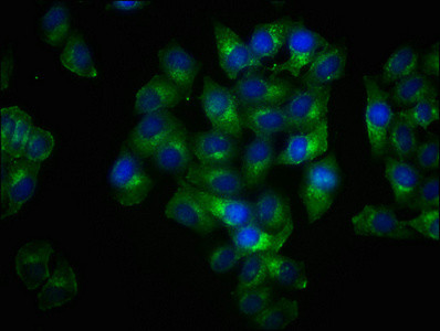 Immunofluorescence staining of Hela cells with CSB-RA012767A191phHU at 1:100,counter-stained with DAPI. The cells were fixed in 4% formaldehyde, permeabilized using 0.2% Triton X-100 and blocked in 10% normal Goat Serum. The cells were then incubated with the antibody overnight at 4&deg;C. The secondary antibody was Alexa Fluor 488-congugated AffiniPure Goat Anti-Rabbit IgG (H+L).