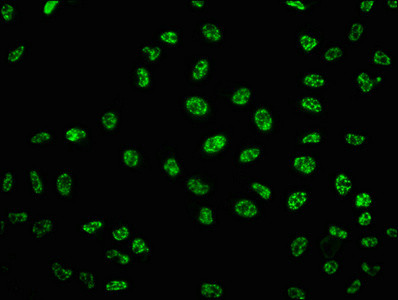 Immunofluorescence staining of Hela cells with CSB-RA024077A33phHU at 1:100,counter-stained with DAPI. The cells were fixed in 4% formaldehyde, permeabilized using 0.2% Triton X-100 and blocked in 10% normal Goat Serum. The cells were then incubated with the antibody overnight at 4℃. The secondary antibody was Alexa Fluor 488-congugated AffiniPure Goat Anti-Rabbit IgG (H+L).