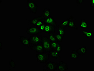 Immunofluorescence staining of Hela cells with CSB-RA008968A2448phHU at 1:100,counter-stained with DAPI. The cells were fixed in 4% formaldehyde, permeabilized using 0.2% Triton X-100 and blocked in 10% normal Goat Serum. The cells were then incubated with the antibody overnight at 4℃. The secondary antibody was Alexa Fluor 488-congugated AffiniPure Goat Anti-Rabbit IgG (H+L).
