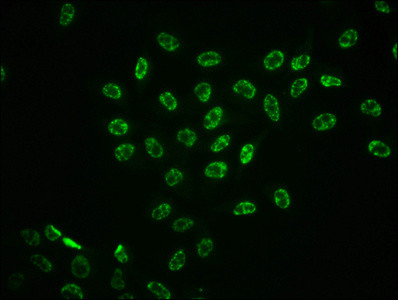 Immunofluorescence staining of Hela cells with CSB-RA013456A185phHU at 1:100,counter-stained with DAPI. The cells were fixed in 4% formaldehyde, permeabilized using 0.2% Triton X-100 and blocked in 10% normal Goat Serum. The cells were then incubated with the antibody overnight at 4℃. The secondary antibody was Alexa Fluor 488-congugated AffiniPure Goat Anti-Rabbit IgG (H+L).