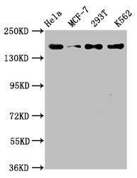 Western Blot<br />Positive WB detected in: Hela whole cell lysate, MCF-7 whole cell lysate, 293T whole cell lysate, K562 whole cell lysate<br />All lanes: HDAC9 antibody at 1.54μg/ml<br />Secondary<br />Goat polyclonal to rabbit IgG at 1/50000 dilution<br />Predicted band size: 112, 102, 66, 98, 118, 113, 61, 63, 58 KDa<br />Observed band size: 160 KDa<br />