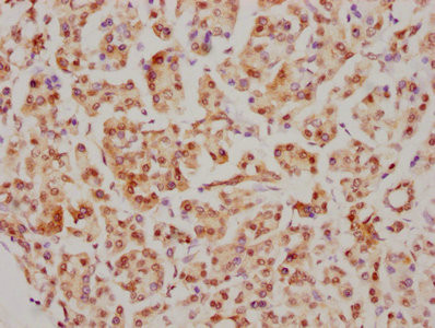 IHC image of CSB-RA858712A0HU diluted at 1:126.5 and staining in paraffin-embedded human pancreatic tissue performed on a Leica BondTM system. After dewaxing and hydration, antigen retrieval was mediated by high pressure in a citrate buffer (pH 6.0). Section was blocked with 10% normal goat serum 30min at RT. Then primary antibody (1% BSA) was incubated at 4℃ overnight. The primary is detected by a biotinylated secondary antibody and visualized using an HRP conjugated SP system.