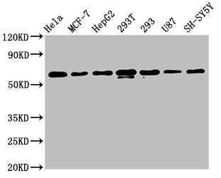 Western Blot<br />Positive WB detected in: Hela whole cell lysate, MCF-7 whole cell lysate, HepG2 whole cell lysate, 293T whole cell lysate, 293 whole cell lysate, U87 whole cell lysate, SH-SY5Y whole cell lysate<br />All lanes: HNRNPK antibody at 1.3μg/ml<br />Secondary<br />Goat polyclonal to rabbit IgG at 1/50000 dilution<br />Predicted band size: 51, 52, 49 KDa<br />Observed band size: 60 KDa<br />