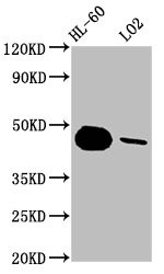 Western Blot<br />Positive WB detected in: HL-60 whole cell lysate, LO2 whole cell lysate<br />All lanes: CASP9 antibody at 1.8μg/ml<br />Secondary<br />Goat polyclonal to rabbit IgG at 1/50000 dilution<br />Predicted band size: 47, 31, 18, 37 KDa<br />Observed band size: 47 KDa<br />