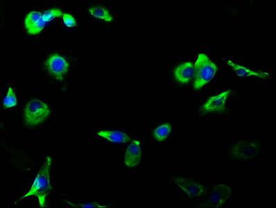 Immunofluorescence staining of MCF-7 cells with CSB-RA009900A0HU at 1:56, counter-stained with DAPI. The cells were fixed in 4% formaldehyde, permeabilized using 0.2% Triton X-100 and blocked in 10% normal Goat Serum. The cells were then incubated with the antibody overnight at 4℃. The secondary antibody was Alexa Fluor 488-congugated AffiniPure Goat Anti-Rabbit IgG (H+L).