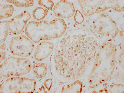 IHC image of CSB-RA009356A0HU diluted at 1:107.5 and staining in paraffin-embedded human kidney tissue performed on a Leica BondTM system. After dewaxing and hydration, antigen retrieval was mediated by high pressure in a citrate buffer (pH 6.0). Section was blocked with 10% normal goat serum 30min at RT. Then primary antibody (1% BSA) was incubated at 4℃ overnight. The primary is detected by a biotinylated secondary antibody and visualized using an HRP conjugated SP system.