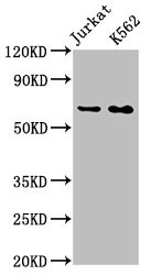 Western Blot<br />
Positive WB detected in: Jurkat whole cell lysate, K562 whole cell lysate<br />
All lanes: STIP1 antibody at 0.9μg/ml<br />
Secondary<br />
Goat polyclonal to rabbit IgG at 1/50000 dilution<br />
Predicted band size: 63, 69, 60 KDa<br />
Observed band size: 63 KDa<br />