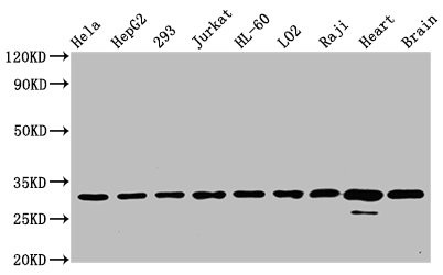 Western Blot<br />Positive WB detected in: Hela whole cell lysate, HepG2 whole cell lysate, 293 whole cell lysate, Jurkat whole cell lysate, HL-60 whole cell lysate, LO2 whole cell lysate, Raji whole cell lysate, Rat heart tissue, Mouse brain tissue<br />All lanes: VDAC1 antibody at 0.7μg/ml<br />Secondary<br />Goat polyclonal to rabbit IgG at 1/50000 dilution<br />Predicted band size: 31 KDa<br />Observed band size: 31 KDa<br />