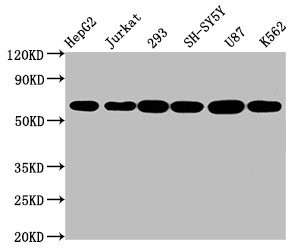Western Blot<br />Positive WB detected in: HepG2 whole cell lysate, Jurkat whole cell lysate, 293 whole cell lysate, SH-SY5Y whole cell lysate, U87 whole cell lysate, K562 whole cell lysate<br />All lanes: CYP19A1 antibody at 2.3μg/ml<br />Secondary<br />Goat polyclonal to rabbit IgG at 1/50000 dilution<br />Predicted band size: 58, 25 KDa<br />Observed band size: 58 KDa<br />