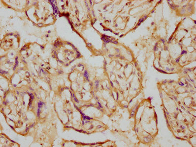 IHC image of CSB-RA006394A0HU diluted at 1:230 and staining in paraffin-embedded human placenta tissue performed on a Leica BondTM system. After dewaxing and hydration, antigen retrieval was mediated by high pressure in a citrate buffer (pH 6.0). Section was blocked with 10% normal goat serum 30min at RT. Then primary antibody (1% BSA) was incubated at 4℃ overnight. The primary is detected by a biotinylated secondary antibody and visualized using an HRP conjugated SP system.