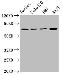 Western Blot<br />Positive WB detected in: Jurkat whole cell lysate, Colo320 whole cell lysate, U87 whole cell lysate, Raji whole cell lysate<br />All lanes: HSPA8 antibody at 1.72μg/ml<br />Secondary<br />Goat polyclonal to rabbit IgG at 1/50000 dilution<br />Predicted band size: 71, 54 KDa<br />Observed band size: 71 KDa<br />