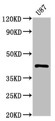 Western Blot<br />
Positive WB detected in: U87 whole cell lysate<br />
All lanes: PRKAR1A antibody at 1.1μg/ml<br />
Secondary<br />
Goat polyclonal to rabbit IgG at 1/50000 dilution<br />
Predicted band size: 43, 39 KDa<br />
Observed band size: 43 KDa<br />