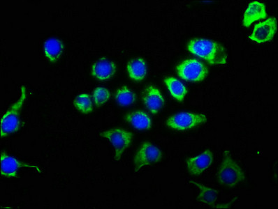 Immunofluorescence staining of A549 cells with CSB-RA004950A0HU at 1:51, counter-stained with DAPI. The cells were fixed in 4% formaldehyde, permeabilized using 0.2% Triton X-100 and blocked in 10% normal Goat Serum. The cells were then incubated with the antibody overnight at 4℃. The secondary antibody was Alexa Fluor 488-congugated AffiniPure Goat Anti-Rabbit IgG (H+L).