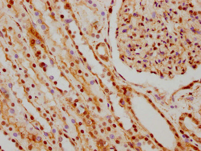IHC image of CSB-RA010605A0HU diluted at 1:66.35 and staining in paraffin-embedded human kidney tissue performed on a Leica BondTM system. After dewaxing and hydration, antigen retrieval was mediated by high pressure in a citrate buffer (pH 6.0). Section was blocked with 10% normal goat serum 30min at RT. Then primary antibody (1% BSA) was incubated at 4℃ overnight. The primary is detected by a biotinylated secondary antibody and visualized using an HRP conjugated SP system.