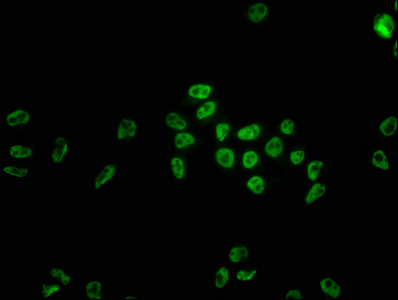 Immunofluorescence staining of Hela cells with CSB-RA010605A0HU at 1:22, counter-stained with DAPI. The cells were fixed in 4% formaldehyde, permeabilized using 0.2% Triton X-100 and blocked in 10% normal Goat Serum. The cells were then incubated with the antibody overnight at 4℃. The secondary antibody was Alexa Fluor 488-congugated AffiniPure Goat Anti-Rabbit IgG (H+L).