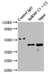 Immunoprecipitating hnRNP C1 + C2 in Hela whole cell lysate<br />
Lane 1: Rabbit control IgG instead of CSB-RA010605A0HU in Hela whole cell lysate.
For western blotting, a HRP-conjugated Protein G antibody was used as the secondary antibody (1/2000)<br />
Lane 2: CSB-RA010605A0HU (3μg) + Hela whole cell lysate (500μg)<br />
Lane 3: Hela whole cell lysate (20μg)<br />