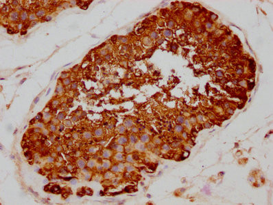 IHC image of CSB-RA011087A0HU diluted at 1:80 and staining in paraffin-embedded human testis tissue performed on a Leica BondTM system. After dewaxing and hydration, antigen retrieval was mediated by high pressure in a citrate buffer (pH 6.0). Section was blocked with 10% normal goat serum 30min at RT. Then primary antibody (1% BSA) was incubated at 4℃ overnight. The primary is detected by a biotinylated secondary antibody and visualized using an HRP conjugated SP system.