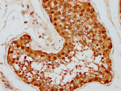 IHC image of CSB-RA011087A1HU diluted at 1:87.5 and staining in paraffin-embedded human testis tissue performed on a Leica BondTM system. After dewaxing and hydration, antigen retrieval was mediated by high pressure in a citrate buffer (pH 6.0). Section was blocked with 10% normal goat serum 30min at RT. Then primary antibody (1% BSA) was incubated at 4℃ overnight. The primary is detected by a biotinylated secondary antibody and visualized using an HRP conjugated SP system.