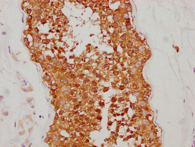 IHC image of CSB-RA011087A2HU diluted at 1:190 and staining in paraffin-embedded human testis tissue performed on a Leica BondTM system. After dewaxing and hydration, antigen retrieval was mediated by high pressure in a citrate buffer (pH 6.0). Section was blocked with 10% normal goat serum 30min at RT. Then primary antibody (1% BSA) was incubated at 4℃ overnight. The primary is detected by a biotinylated secondary antibody and visualized using an HRP conjugated SP system.