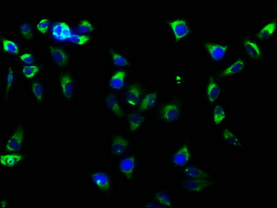 Immunofluorescence staining of Hela cells with CSB-RA011880A0HU at 1:61, counter-stained with DAPI. The cells were fixed in 4% formaldehyde, permeabilized using 0.2% Triton X-100 and blocked in 10% normal Goat Serum. The cells were then incubated with the antibody overnight at 4℃. The secondary antibody was Alexa Fluor 488-congugated AffiniPure Goat Anti-Rabbit IgG (H+L).