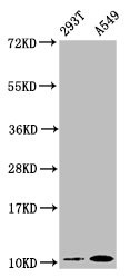 Western Blot<br />
Positive WB detected in: 293T whole cell lysate, A549 whole cell lysate<br />
All lanes: Apolipoprotein A II antibody at 0.87μg/ml<br />
Secondary<br />
Goat polyclonal to rabbit IgG at 1/50000 dilution<br />
Predicted band size: 12 KDa<br />
Observed band size: 12 KDa<br />