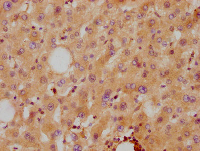 IHC image of CSB-RA001915A0HU diluted at 1:87.5 and staining in paraffin-embedded human liver tissue performed on a Leica BondTM system. After dewaxing and hydration, antigen retrieval was mediated by high pressure in a citrate buffer (pH 6.0). Section was blocked with 10% normal goat serum 30min at RT. Then primary antibody (1% BSA) was incubated at 4℃ overnight. The primary is detected by a biotinylated secondary antibody and visualized using an HRP conjugated SP system.