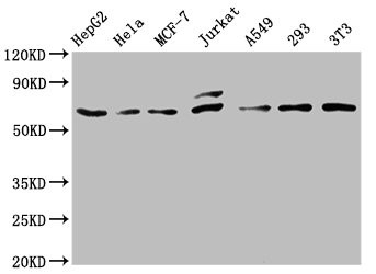 Western Blot<br />
Positive WB detected in: HepG2 whole cell lysate, Hela whole cell lysate, MCF-7 whole cell lysate, Jurkat whole cell lysate, A549 whole cell lysate, 293 whole cell lysate, NIH/3T3 whole cell lysate<br />
All lanes: c-FOS antibody at 0.81μg/ml<br />
Secondary<br />
Goat polyclonal to rabbit IgG at 1/50000 dilution<br />
Predicted band size: 41, 29, 37 KDa<br />
Observed band size: 62 KDa<br />
