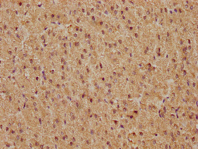 IHC image of CSB-RA008790A0HU diluted at 1:81 and staining in paraffin-embedded human adrenal gland tissue performed on a Leica BondTM system. After dewaxing and hydration, antigen retrieval was mediated by high pressure in a citrate buffer (pH 6.0). Section was blocked with 10% normal goat serum 30min at RT. Then primary antibody (1% BSA) was incubated at 4℃ overnight. The primary is detected by a biotinylated secondary antibody and visualized using an HRP conjugated SP system.