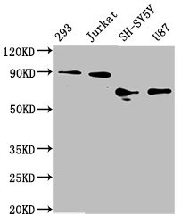 Western Blot<br />
Positive WB detected in: 293 whole cell lysate, Jurkat whole cell lysate, SH-SY5Y whole cell lysate, U87 whole cell lysate<br />
All lanes: FOXO3A antibody at 1.8μg/ml<br />
Secondary<br />
Goat polyclonal to rabbit IgG at 1/50000 dilution<br />
Predicted band size: 72, 49 KDa<br />
Observed band size: 72-90 KDa<br />