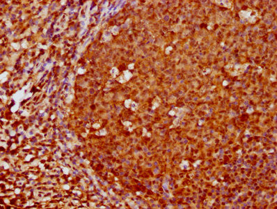 IHC image of CSB-RA008836A0HU diluted at 1:180 and staining in paraffin-embedded human tonsil tissue performed on a Leica BondTM system. After dewaxing and hydration, antigen retrieval was mediated by high pressure in a citrate buffer (pH 6.0). Section was blocked with 10% normal goat serum 30min at RT. Then primary antibody (1% BSA) was incubated at 4℃ overnight. The primary is detected by a biotinylated secondary antibody and visualized using an HRP conjugated SP system.
