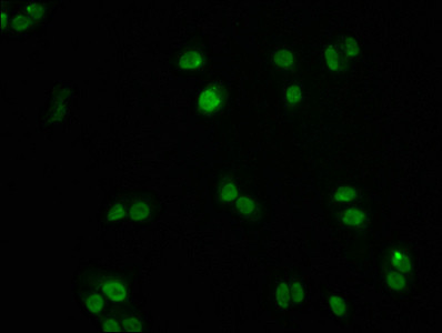 Immunofluorescence staining of PC3 cells with CSB-RA008836A0HU at 1:60, counter-stained with DAPI. The cells were fixed in 4% formaldehyde, permeabilized using 0.2% Triton X-100 and blocked in 10% normal Goat Serum. The cells were then incubated with the antibody overnight at 4℃. The secondary antibody was Alexa Fluor 488-congugated AffiniPure Goat Anti-Rabbit IgG (H+L).