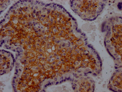 IHC image of CSB-RA213932A0HU diluted at 1:100 and staining in paraffin-embedded human placenta tissue performed on a Leica BondTM system. After dewaxing and hydration, antigen retrieval was mediated by high pressure in a citrate buffer (pH 6.0). Section was blocked with 10% normal goat serum 30min at RT. Then primary antibody (1% BSA) was incubated at 4℃ overnight. The primary is detected by a Goat anti-rabbit IgG polymer labeled by HRP and visualized using 0.05% DAB.