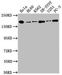 Western Blot<br />Positive WB detected in: Hela whole cell lysate, HL60 whole cell lysate, K562 whole cell lysate, SH-SY5Y whole cell lysate, U251 whole cell lysate, PC-3 whole cell lysate<br />All lanes: DOT1L antibody at 1:1500<br />Secondary<br />Goat polyclonal to rabbit IgG at 1/50000 dilution<br />Predicted band size: 165, 185 kDa<br />Observed band size: 185 kDa<br />
