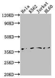 Western Blot<br />
Positive WB detected in: Hela whole cell lysate, K562 whole cell lysate, Jurkat whole cell lysate, HL60 whole cell lysate<br />
All lanes: TBP antibody at 1:2000<br />
Secondary<br />
Goat polyclonal to rabbit IgG at 1/50000 dilution<br />
Predicted band size: 38, 36 kDa<br />
Observed band size: 36 kDa<br />