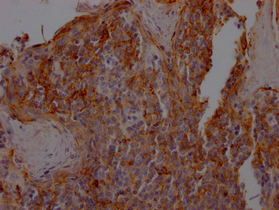 IHC image of CSB-RA162789A0HU diluted at 1:100 and staining in paraffin-embedded human tonsil tissue performed on a Leica BondTM system. After dewaxing and hydration, antigen retrieval was mediated by high pressure in a citrate buffer (pH 6.0). Section was blocked with 10% normal goat serum 30min at RT. Then primary antibody (1% BSA) was incubated at 4℃ overnight. The primary is detected by a Goat anti-rabbit IgG polymer labeled by HRP and visualized using 0.05% DAB.
