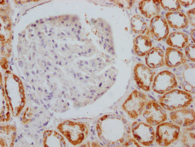 IHC image of CSB-RA296617A0HU diluted at 1:100 and staining in paraffin-embedded human kidney tissue performed on a Leica BondTM system. After dewaxing and hydration, antigen retrieval was mediated by high pressure in a citrate buffer (pH 6.0). Section was blocked with 10% normal goat serum 30min at RT. Then primary antibody (1% BSA) was incubated at 4℃ overnight. The primary is detected by a Goat anti-rabbit IgG polymer labeled by HRP and visualized using 0.05% DAB.